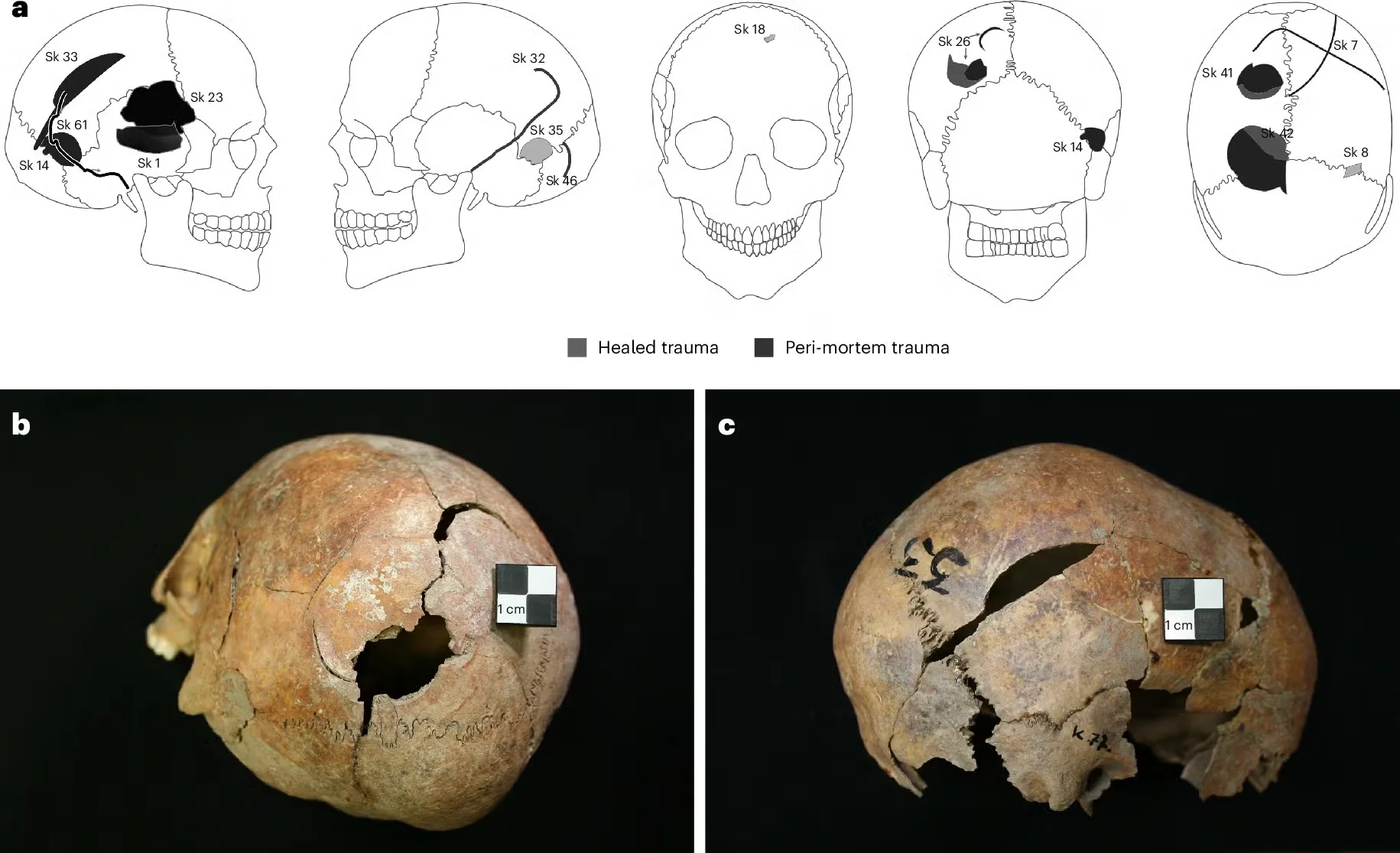 a–c, Distribution and examples of cranial injuries recorded at Gomolava (a), including Sk26 in posterior-lateral view (b) and Sk33 in right-lateral view (c); both individuals had sustained extensive peri-mortem injuries. (CREDIT: Nature Human Behaviour)