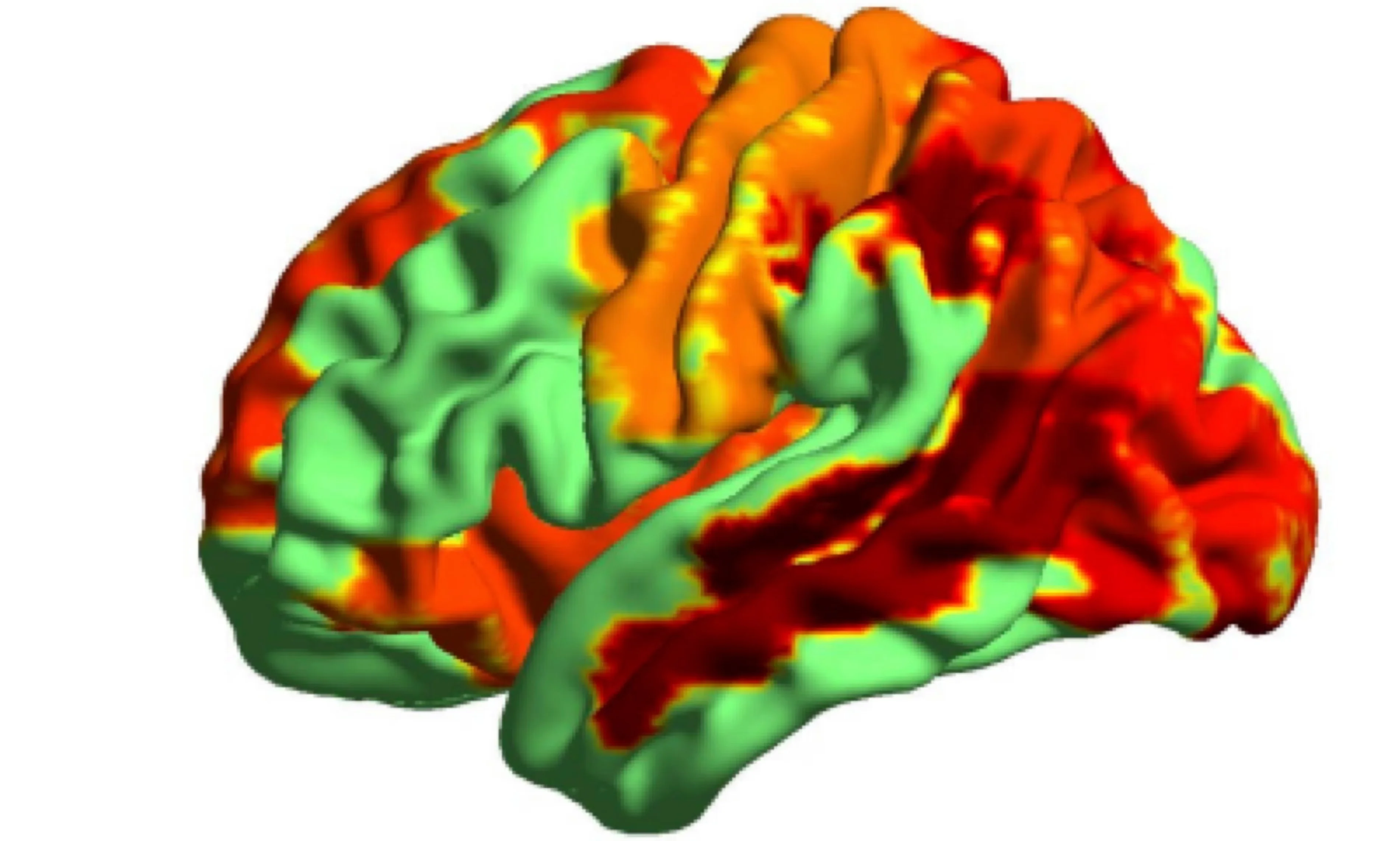 Researchers measured the activity of neurons in people’s brains as the drugs took hold. Photograph: Suresh Muthukumaraswamy